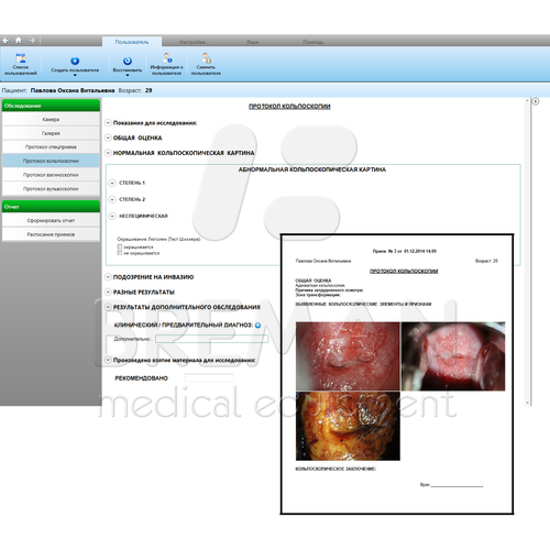 Программное обеспечение для кольпоскопии «MEDVisor»